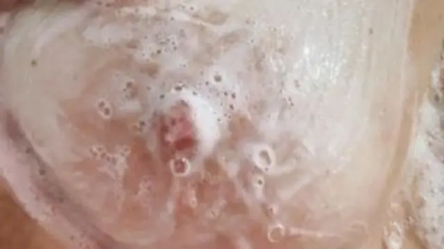 Heißes Wasser, nackte Haut